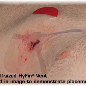 NAR hyfin chest seal in use